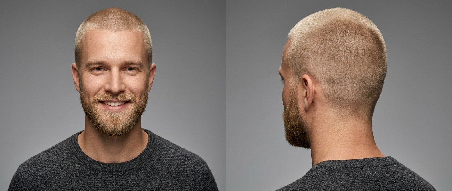 Profil avant et arrière d'un homme caucasien avec une coupe induction blonde ultra-courte et une barbe moyenne bien taillée.