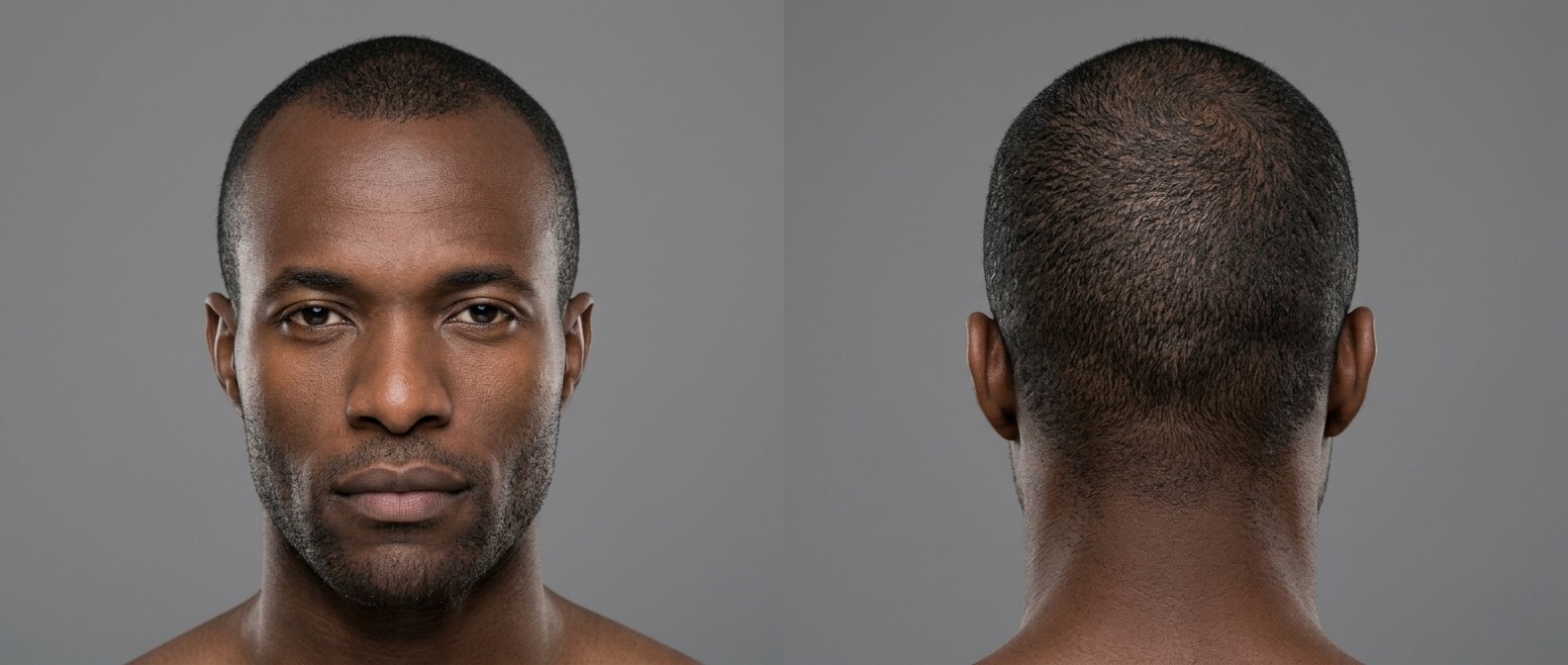Widok z przodu i z tyłu na czarnoskórego mężczyznę z ultra-krótkim induction buzz cut, naturalną linią włosów i lekkim zarostem na szarym tle.