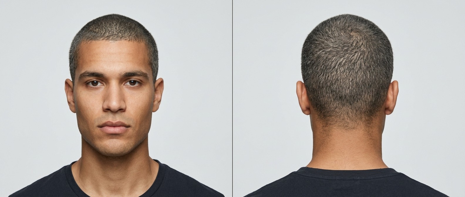 Widok z przodu i z tyłu na młodego mężczyznę z oliwkową cerą i kwadratową szczęką w ultra-krótkim, siwym cięciu typu induction cut z naturalną linią włosów.